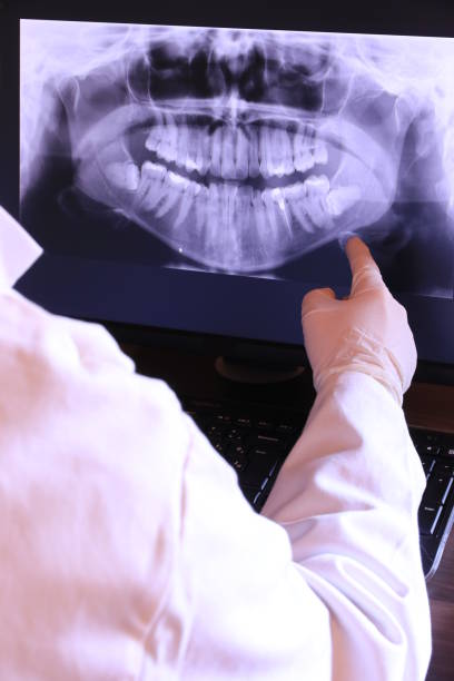 Best Emergency Wisdom Teeth Removal in Daly City, CA