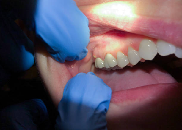 Best Emergency Dental Care for Trauma or Injury in Daly City, CA