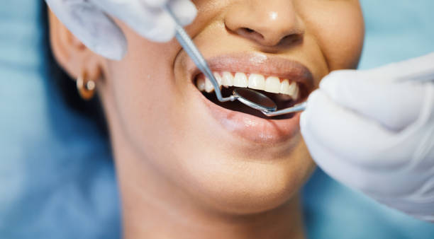 Best Emergency Treatment for Toothache in Daly City, CA