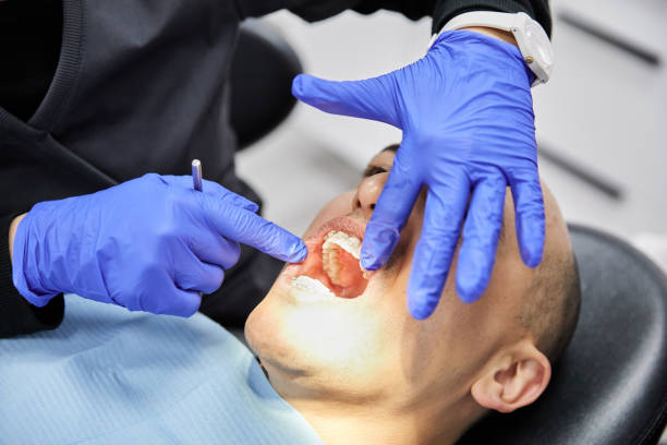 Best Emergency Treatment for Toothache in Daly City, CA